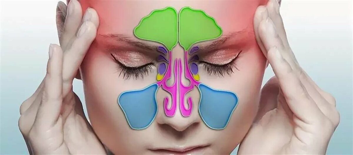 Sinüzitte erken teşhis hayati önem taşıyor